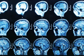 LES EFFETS PSYCHOLOGIQUES DE LA PRATIQUE DU RITUEL MACONNIQUE